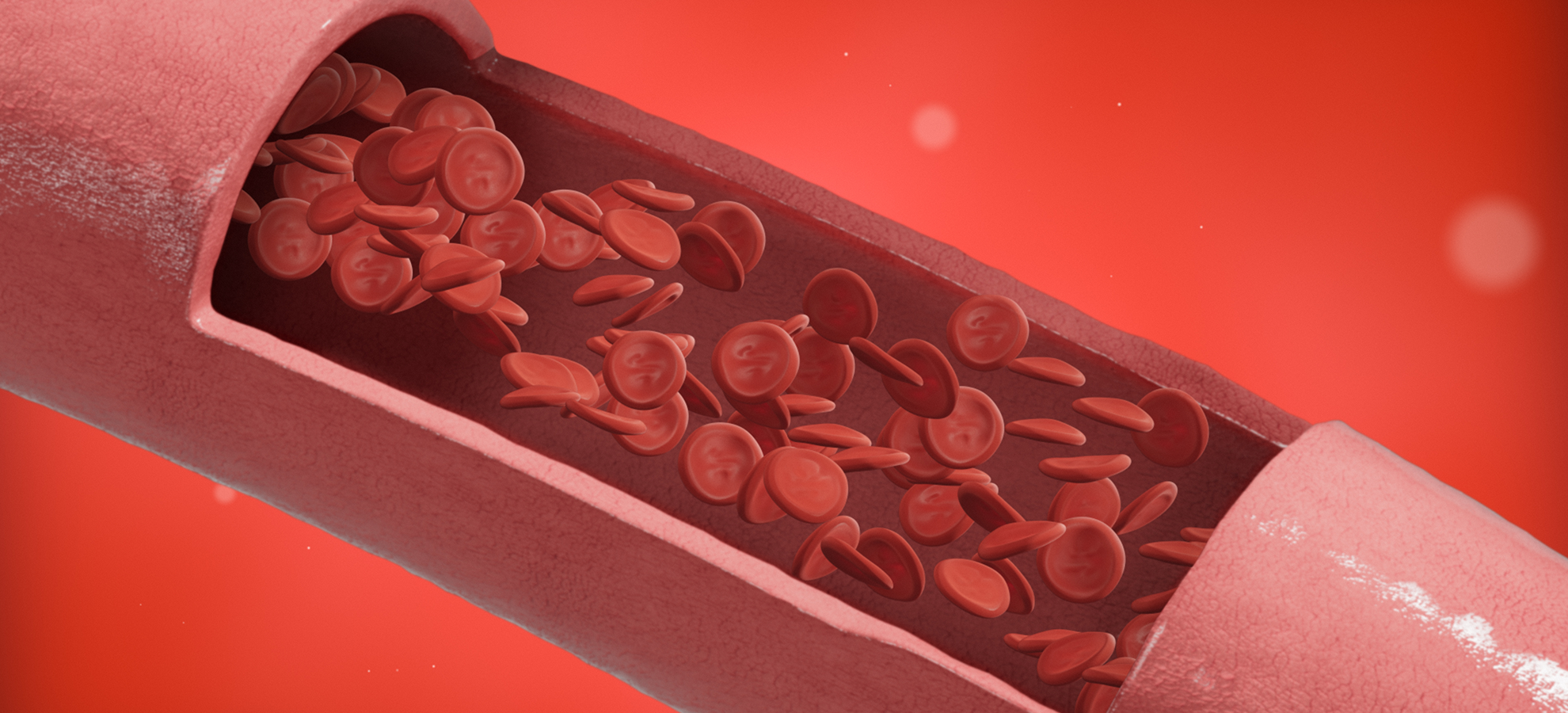 Acesse a notícia comleta: Paciente com doença rara do sangue tem medicamento assegurado pelo TRF5