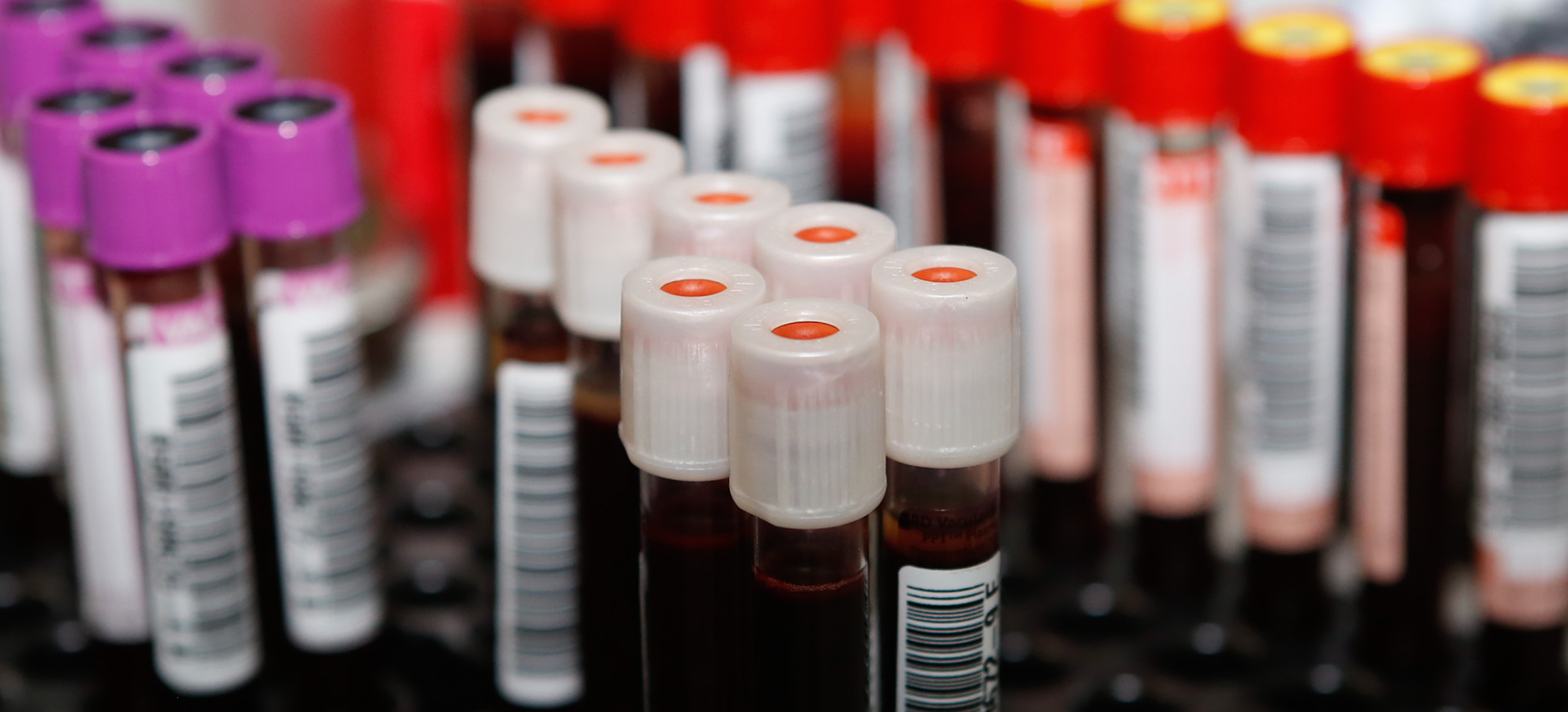 Acesse a notícia comleta: Hemope realiza campanha de doação de sangue no TRF5
